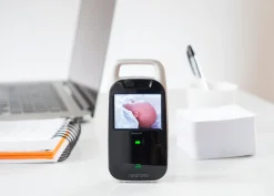 Neonate BC-8000DV babyalarm m. videoovervågning- Babyalarmer